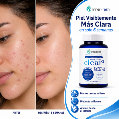 Clear3 -Adiós al Acné Hormonal